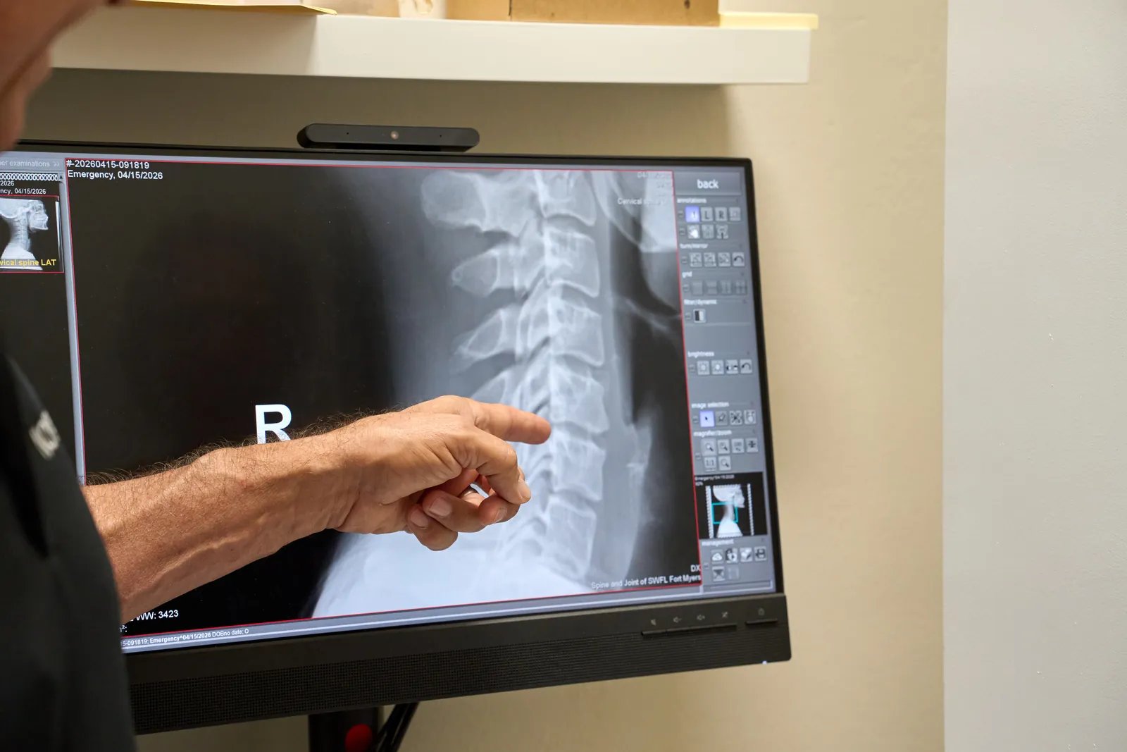 Reviewing a cervical spine X-ray on a diagnostic display at Novarè Injury Care and Rehab