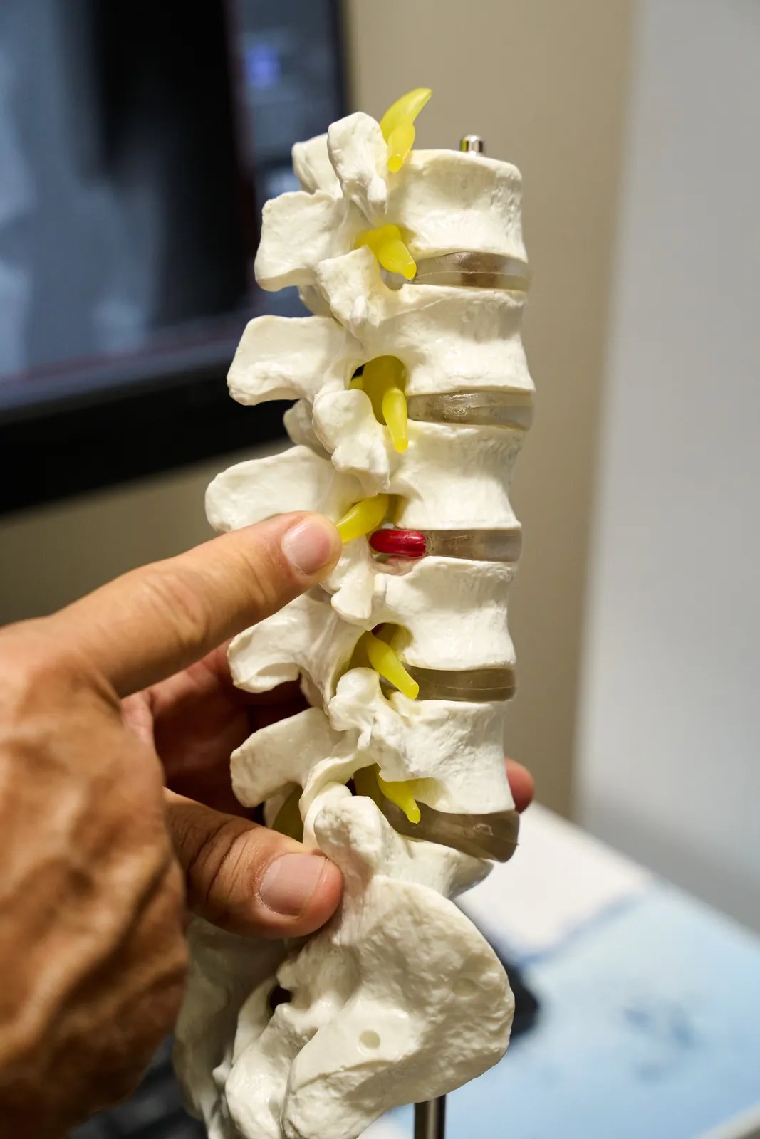 An anatomical spine model used in patient examination